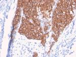 HER-2/c-erbB-2/neu/CD340 Antibody in Immunohistochemistry (Paraffin) (IHC (P))