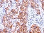 HER-2/c-erbB-2/neu/CD340 Antibody in Immunohistochemistry (Paraffin) (IHC (P))