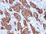 HER-2/c-erbB-2/neu/CD340 Antibody in Immunohistochemistry (Paraffin) (IHC (P))