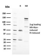 HER-2/c-erbB-2/neu/CD340 Antibody in SDS-PAGE (SDS-PAGE)