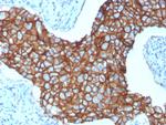 HER-2/c-erbB-2/neu/CD340 Antibody in Immunohistochemistry (Paraffin) (IHC (P))