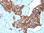 HER-2/c-erbB-2/neu/CD340 Antibody in Immunohistochemistry (Paraffin) (IHC (P))