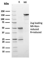 HER-2/c-erbB-2/neu/CD340 Antibody in SDS-PAGE (SDS-PAGE)