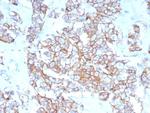 HER-2/c-erbB-2/neu/CD340 Antibody in Immunohistochemistry (Paraffin) (IHC (P))