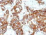 HER-2/c-erbB-2/neu/CD340 Antibody in Immunohistochemistry (Paraffin) (IHC (P))