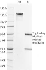 HER-2/c-erbB-2/neu/CD340 Antibody in SDS-PAGE (SDS-PAGE)