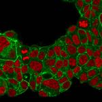 HER-2/c-erbB-2/neu/CD340 Antibody in Immunocytochemistry (ICC/IF)