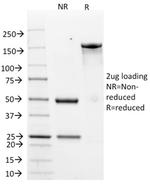 HER-2/c-erbB-2/neu/CD340 Antibody in SDS-PAGE (SDS-PAGE)