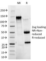 HER-2/c-erbB-2/neu/CD340 Antibody in SDS-PAGE (SDS-PAGE)