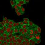 HER-2/c-erbB-2/neu/CD340 Antibody in Immunocytochemistry (ICC/IF)