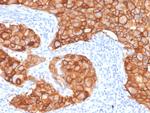 HER-2/c-erbB-2/neu/CD340 Antibody in Immunohistochemistry (Paraffin) (IHC (P))