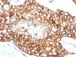 HER-2/c-erbB-2/neu/CD340 Antibody in Immunohistochemistry (Paraffin) (IHC (P))