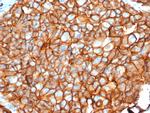 HER-2/c-erbB-2/neu/CD340 Antibody in Immunohistochemistry (Paraffin) (IHC (P))