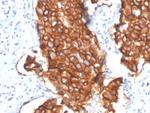 HER-2/c-erbB-2/neu/CD340 Antibody in Immunohistochemistry (Paraffin) (IHC (P))