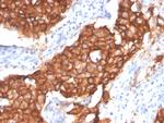 HER-2/c-erbB-2/neu/CD340 Antibody in Immunohistochemistry (Paraffin) (IHC (P))