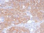 HER-2/c-erbB-2/neu/CD340 Antibody in Immunohistochemistry (Paraffin) (IHC (P))