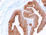 HER-4/ERBB4 Antibody in Immunohistochemistry (Paraffin) (IHC (P))