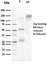 HER-4/ERBB4 Antibody in SDS-PAGE (SDS-PAGE)