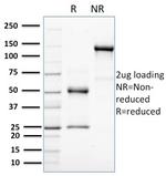 HER-4/ERBB4 Antibody in SDS-PAGE (SDS-PAGE)