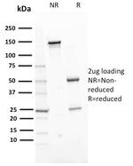 ERCC1/RAD10 (Tumor Progression Marker) Antibody in SDS-PAGE (SDS-PAGE)