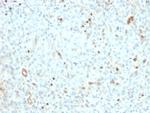 ERCC1/RAD10 (Tumor Progression Marker) Antibody in Immunohistochemistry (Paraffin) (IHC (P))