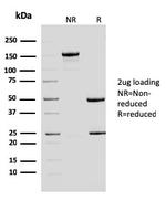 ERCC1/RAD10 (Tumor Progression Marker) Antibody in SDS-PAGE (SDS-PAGE)