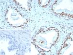 ERCC1/RAD10 (Tumor Progression Marker) Antibody in Immunohistochemistry (Paraffin) (IHC (P))