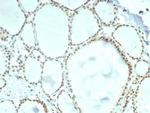 ERCC1/RAD10 (Tumor Progression Marker) Antibody in Immunohistochemistry (Paraffin) (IHC (P))