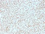 AKT1 Antibody in Immunohistochemistry (Paraffin) (IHC (P))