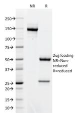 AKT1 Antibody in SDS-PAGE (SDS-PAGE)