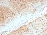 AKT1 Antibody in Immunohistochemistry (Paraffin) (IHC (P))