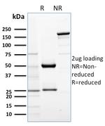 AKT1 Antibody in SDS-PAGE (SDS-PAGE)