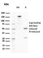 AKT1 Antibody in SDS-PAGE (SDS-PAGE)