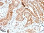 AKT1 Antibody in Immunohistochemistry (Paraffin) (IHC (P))