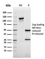 AKT1 Antibody in SDS-PAGE (SDS-PAGE)