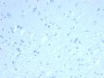 ERG (Vascular Endothelial and Prostate Marker) Antibody in Immunohistochemistry (Paraffin) (IHC (P))