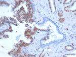 ERG (Vascular Endothelial and Prostate Marker) Antibody in Immunohistochemistry (Paraffin) (IHC (P))