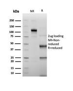 ERG (Vascular Endothelial and Prostate Marker) Antibody in SDS-PAGE (SDS-PAGE)