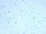 ERG (Vascular Endothelial and Prostate Marker) Antibody in Immunohistochemistry (Paraffin) (IHC (P))