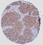 ERG (Vascular Endothelial and Prostate Marker) Antibody in Immunohistochemistry (Paraffin) (IHC (P))