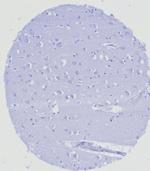 ERG (Vascular Endothelial and Prostate Marker) Antibody in Immunohistochemistry (Paraffin) (IHC (P))