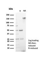 ERG (Vascular Endothelial and Prostate Marker) Antibody in SDS-PAGE (SDS-PAGE)