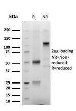 ERG Antibody in SDS-PAGE (SDS-PAGE)