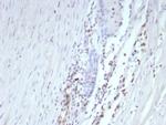 ERG (Vascular Endothelial and Prostate Marker) Antibody in Immunohistochemistry (Paraffin) (IHC (P))