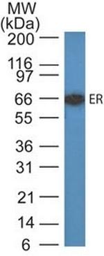 Estrogen Receptor (Marker of Estrogen Dependence) Antibody in Western Blot (WB)