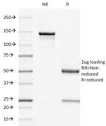 Estrogen Receptor (Marker of Estrogen Dependence) Antibody in SDS-PAGE (SDS-PAGE)