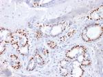 Estrogen Receptor, alpha (Marker of Estrogen Dependence) Antibody in Immunohistochemistry (Paraffin) (IHC (P))