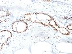 Estrogen Receptor, alpha (Marker of Estrogen Dependence) Antibody in Immunohistochemistry (Paraffin) (IHC (P))