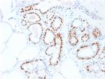 Estrogen Receptor, alpha (Marker of Estrogen Dependence) Antibody in Immunohistochemistry (Paraffin) (IHC (P))