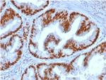 Estrogen Receptor, alpha (Marker of Estrogen Dependence) Antibody in Immunohistochemistry (Paraffin) (IHC (P))